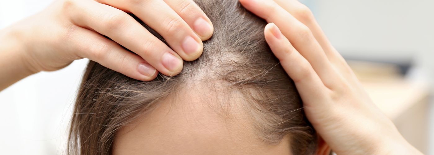 Die Haare für eine Haartransplantation rasieren: Ist das notwendig?